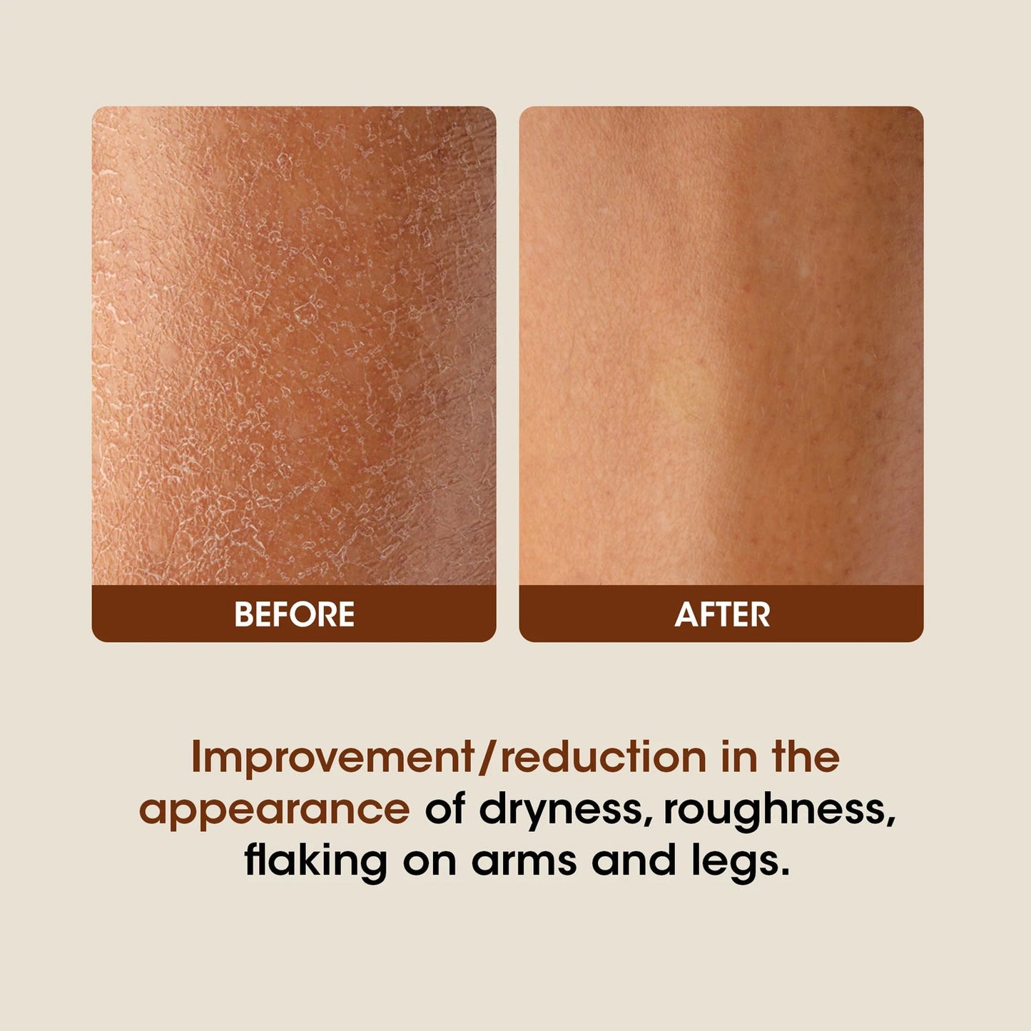 Body Lotion for Winter